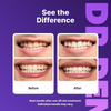 Peroxide-Free Purple Teeth Whitening Strips
