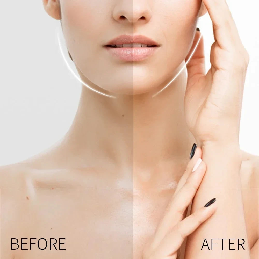 V-Lift Face Tape – Instant Jawline Lift Without Surgery